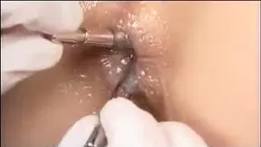 Anal Delight - Deep Dive Into Extreme Back Door Bliss